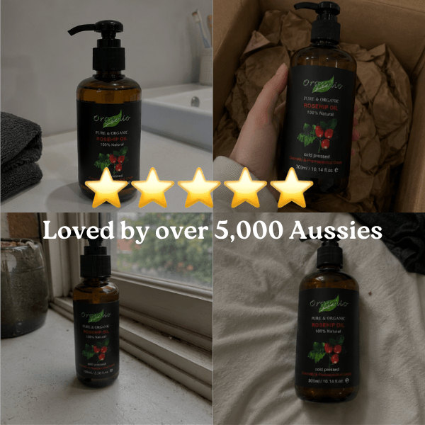 Lather Lab™ Rejuvenating Rosehip Oil (100% Pure, Cold-Pressed)